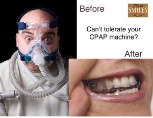 sleep apnea treatment