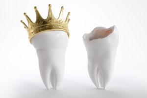 Dental crowns